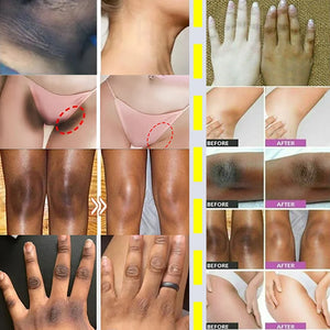 Whitening Cream Sérum Clareador de Partes Íntimas Axilas Clareia Bumbum Joelho Clareia Partes Íntimas Escuras Remove Melanina